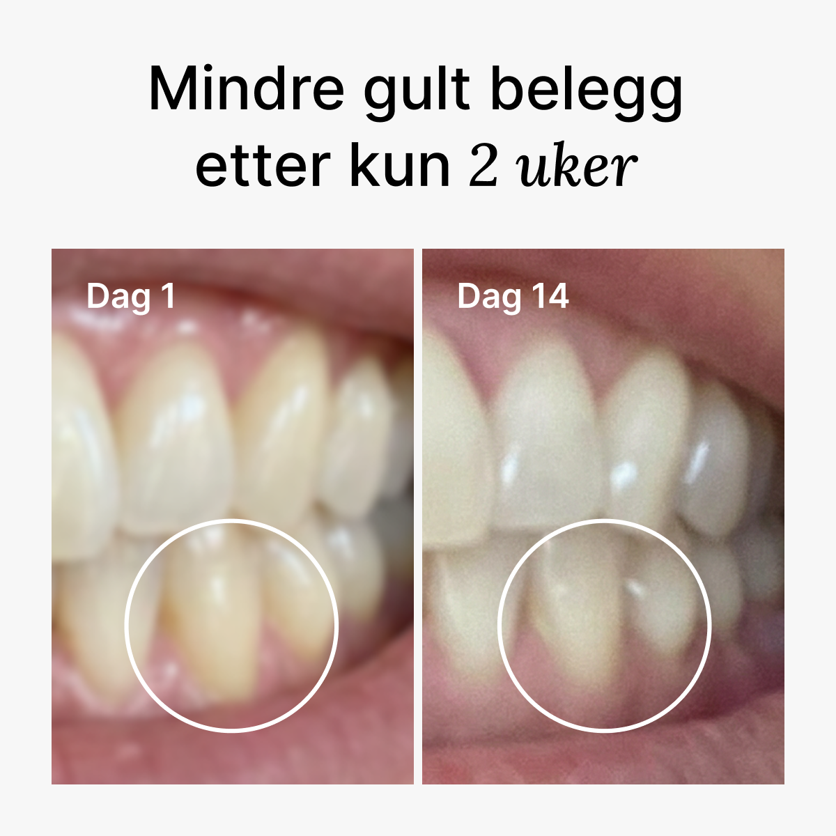 D2 Pro Elektrisk Tannbørste Dentis